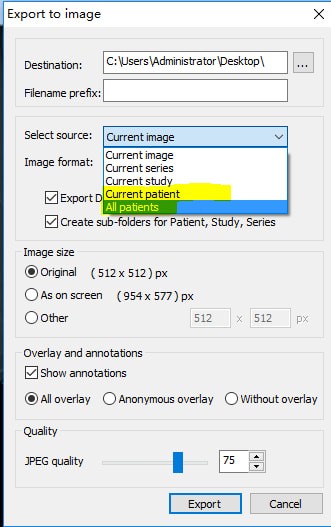 MicroDicom viewer(Dicomʽͼ)