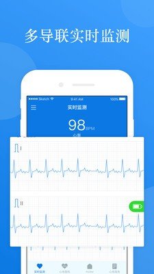 AI ECG