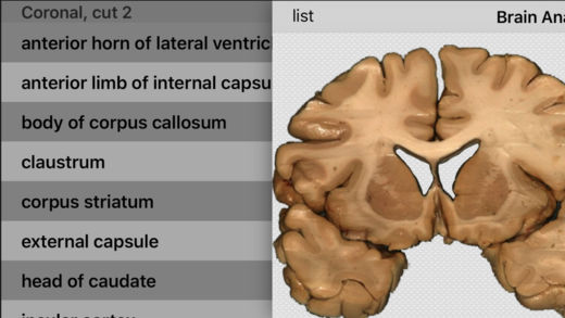 Brain Anatomyͼ1